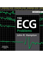 150 ECG Problems. International Edition